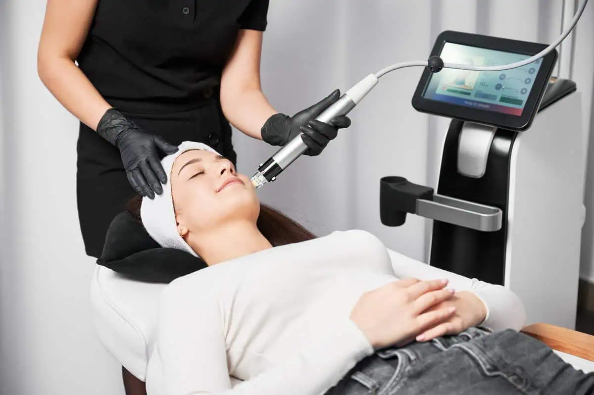 Microneedling Treatment by Aspire Aesthetics And Wellness in Corpus Christi TX