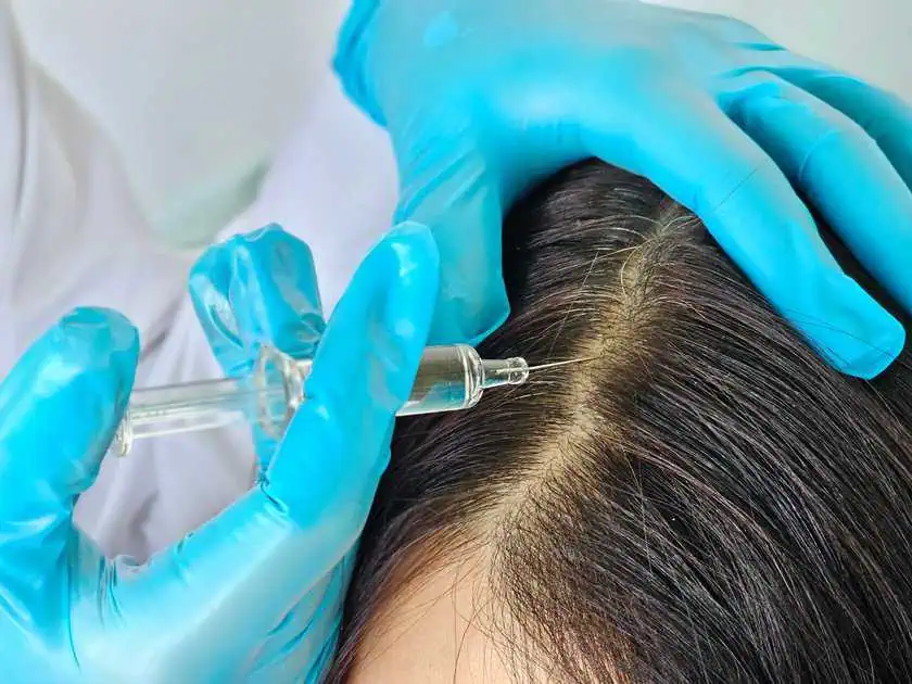 Hair Restoration by Aspire Aesthetics and Wellness Clinic in Corpus Christi,TX